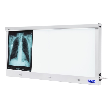 Negatoskop LED NGP 31